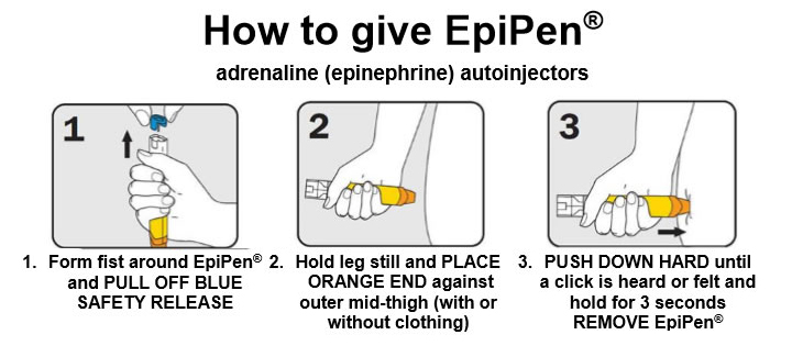 Using Your Epipen® Or Anapen® Young Adults