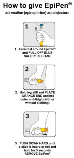 Using your adrenaline (epinephrine) device - Young Adults