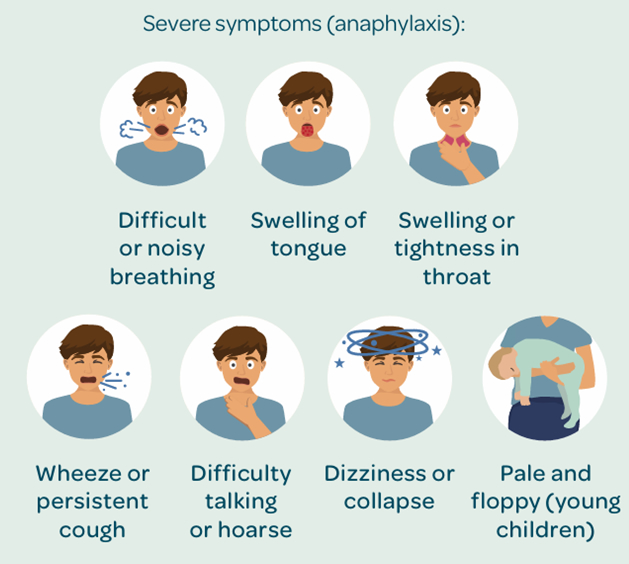 Severe symptoms of an allergic reaction